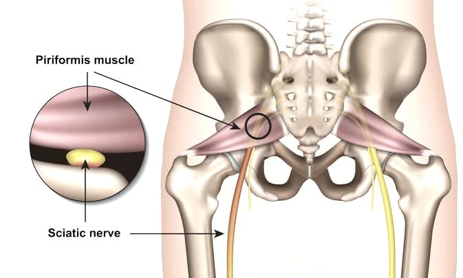 Sciatica And Sciatic Nerve