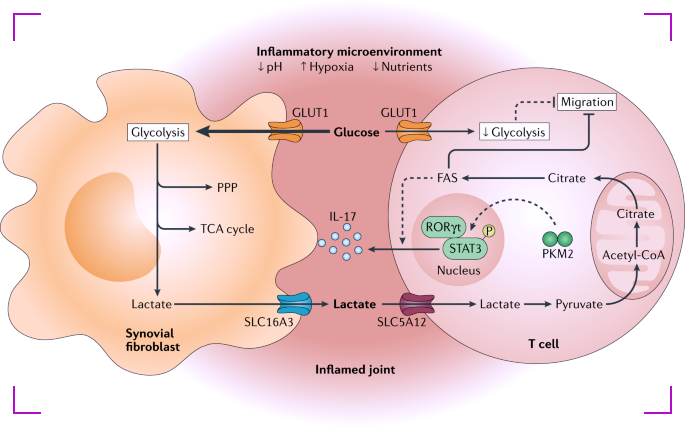 Lactate in Septic Arthritis