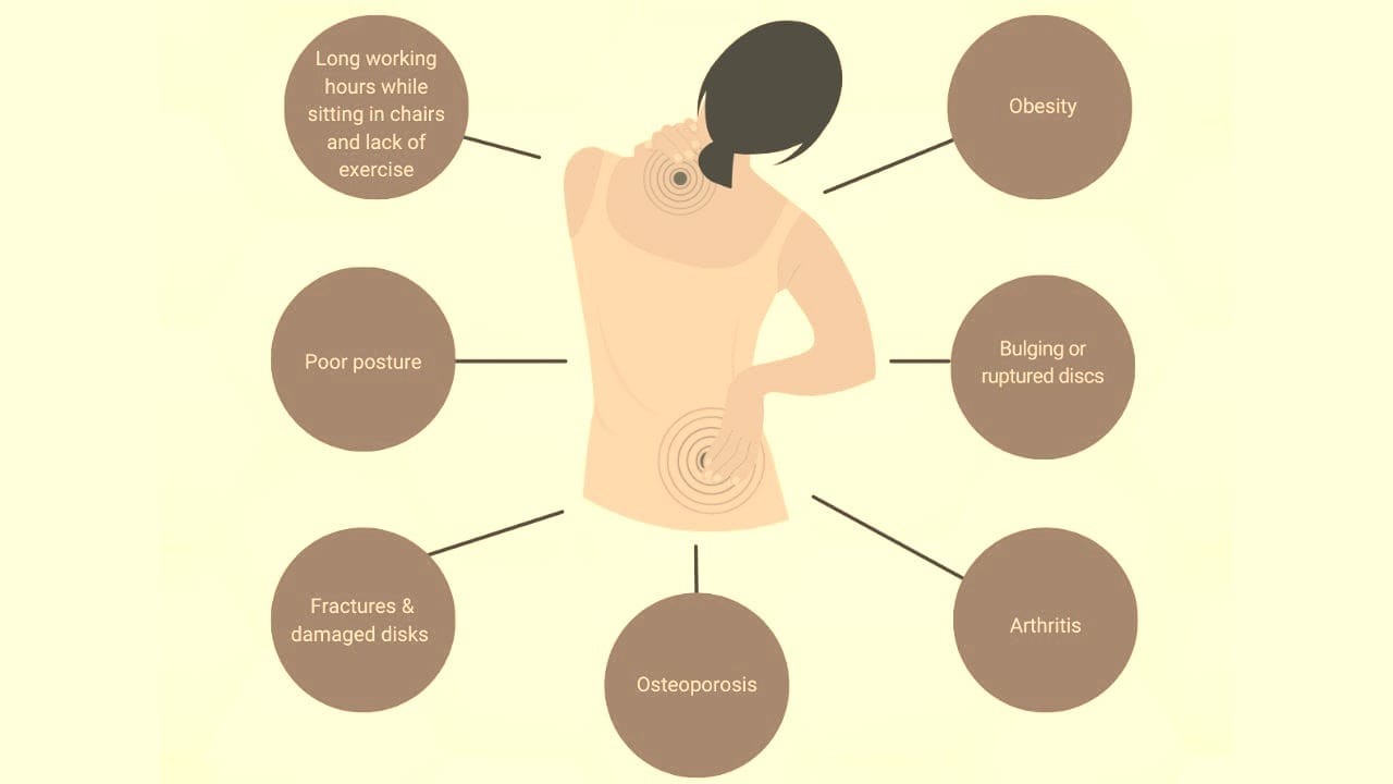 Causes of Sciatica