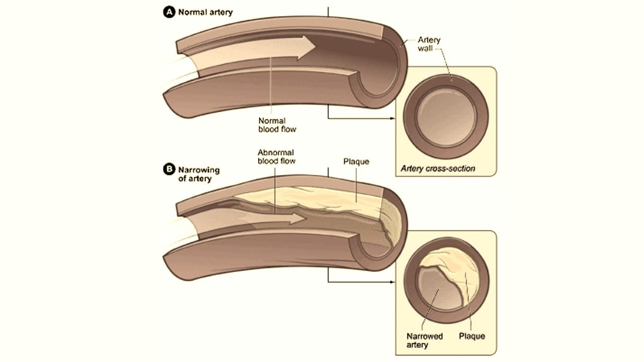 Causes