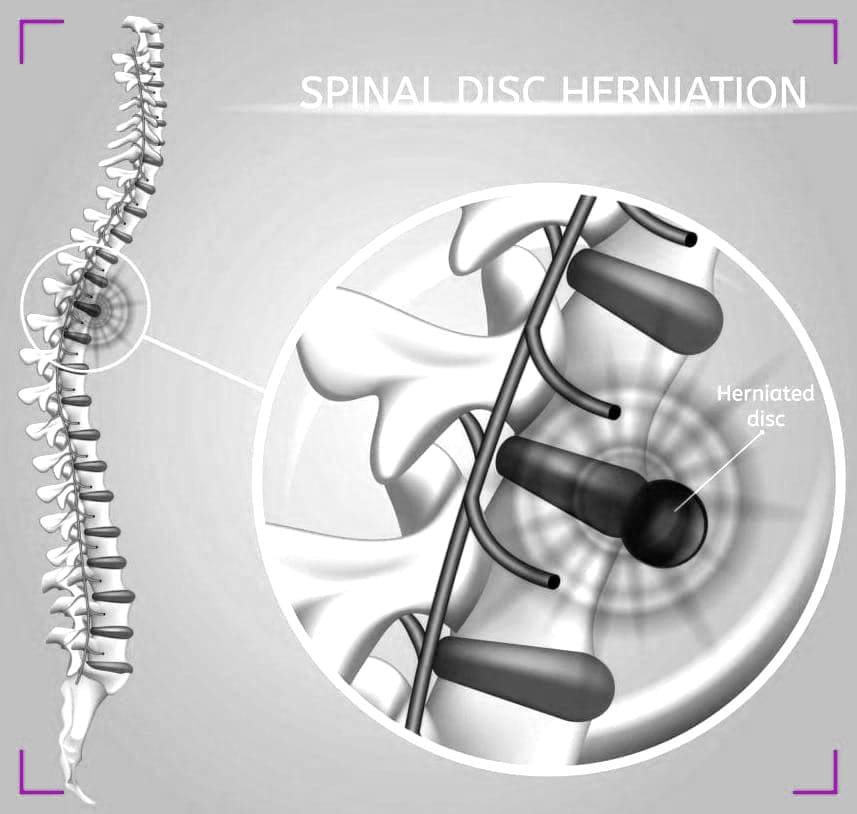 Surgical Interventions