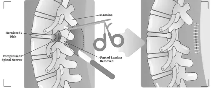 Surgical Interventions