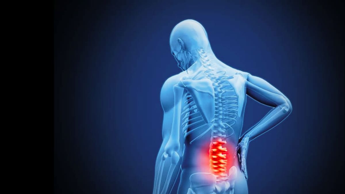 How To Fix Back Pain?