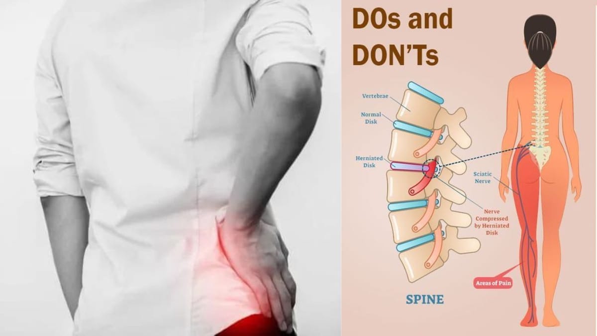 Sciatica Dos and Donts: Your Guide to Managing Pain