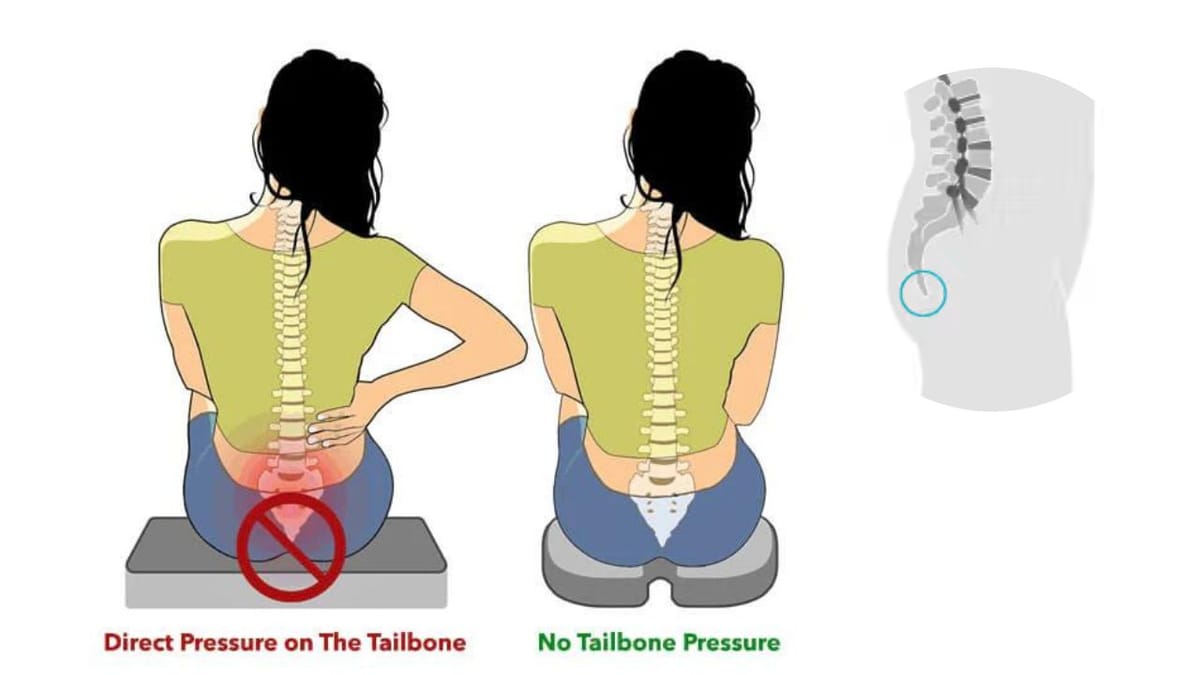 Understanding Why Your Tailbone Sticks Out