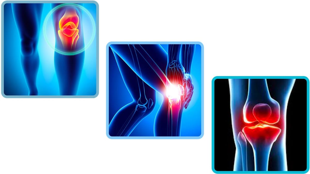 Understanding Septic Arthritis Lactate