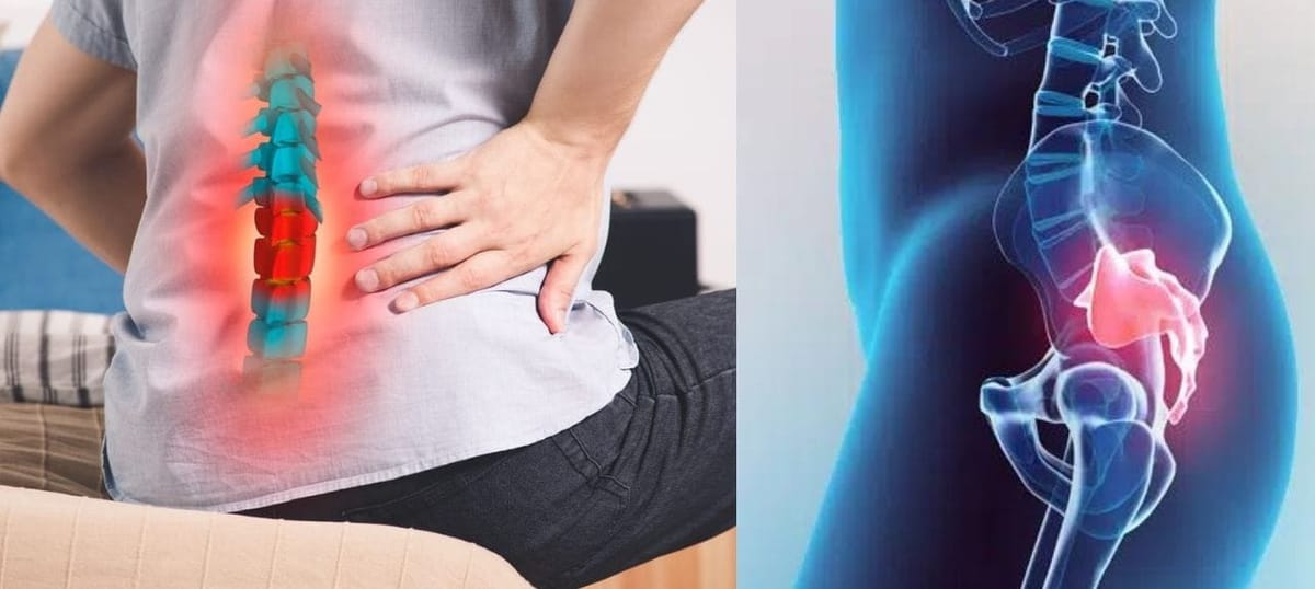 Can Tailbone Pain Radiate To The Buttocks?