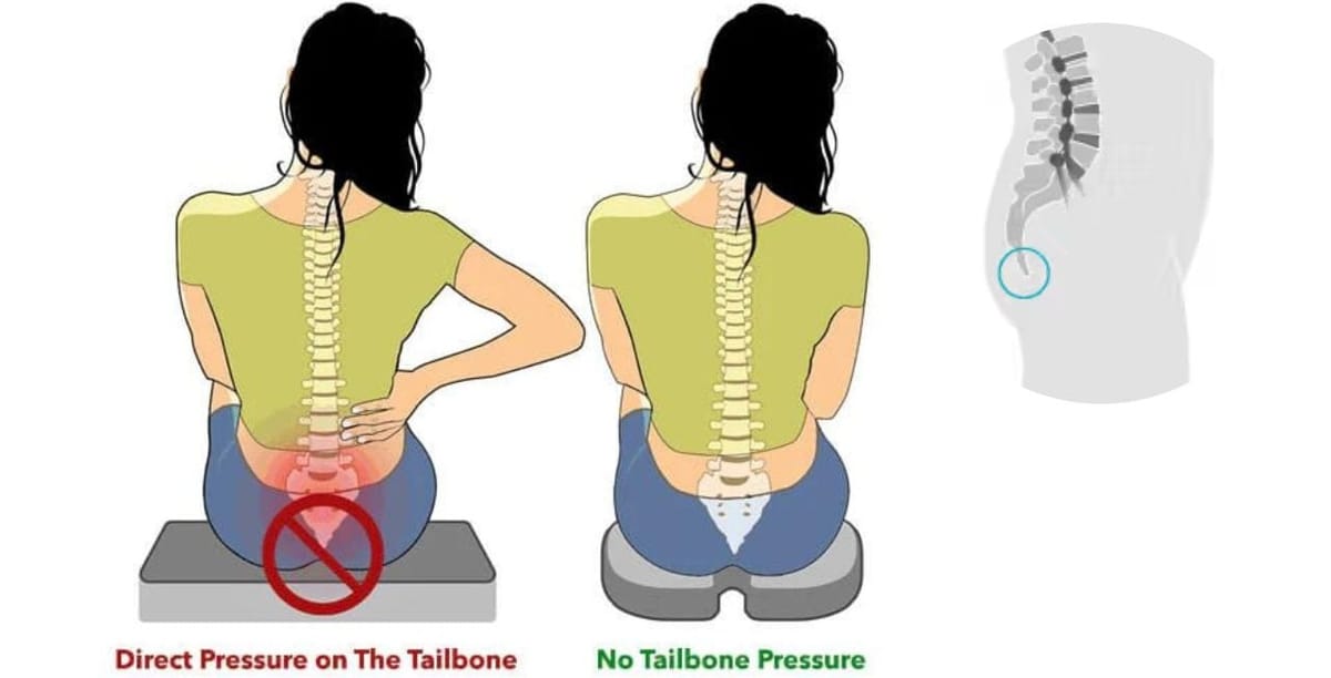 Understanding Why Your Tailbone Sticks Out