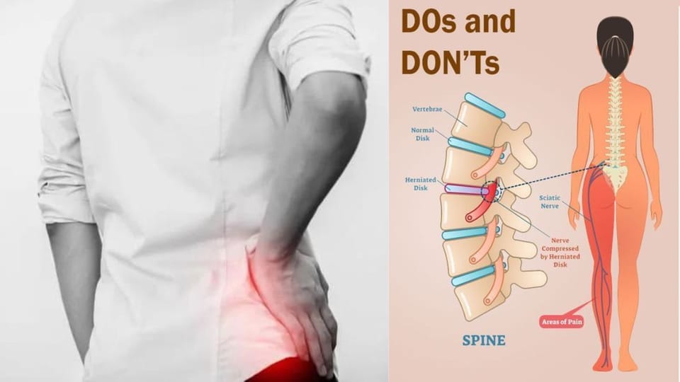 Sciatica Dos And Donts Your Guide To Managing Pain